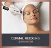 dermal needling richmond dermapen